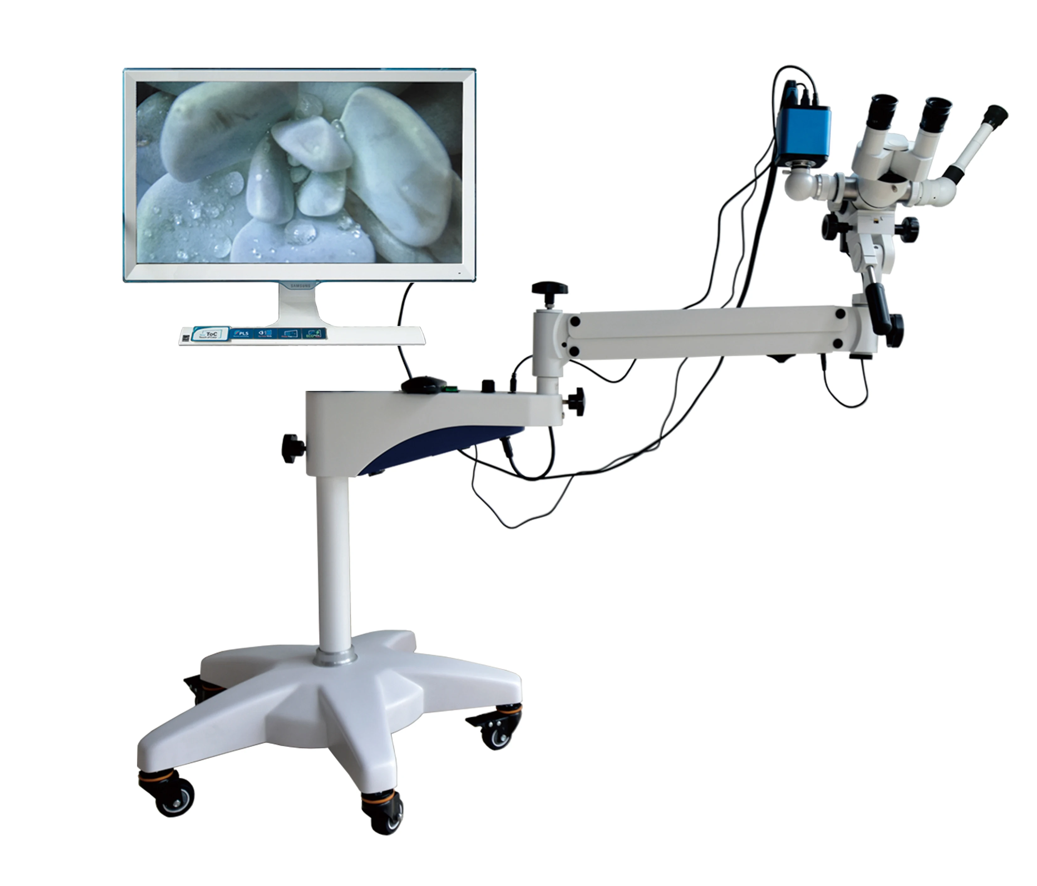 High Precision Portable Movable Digital HD Gynecological Video Colposcopy Microscope