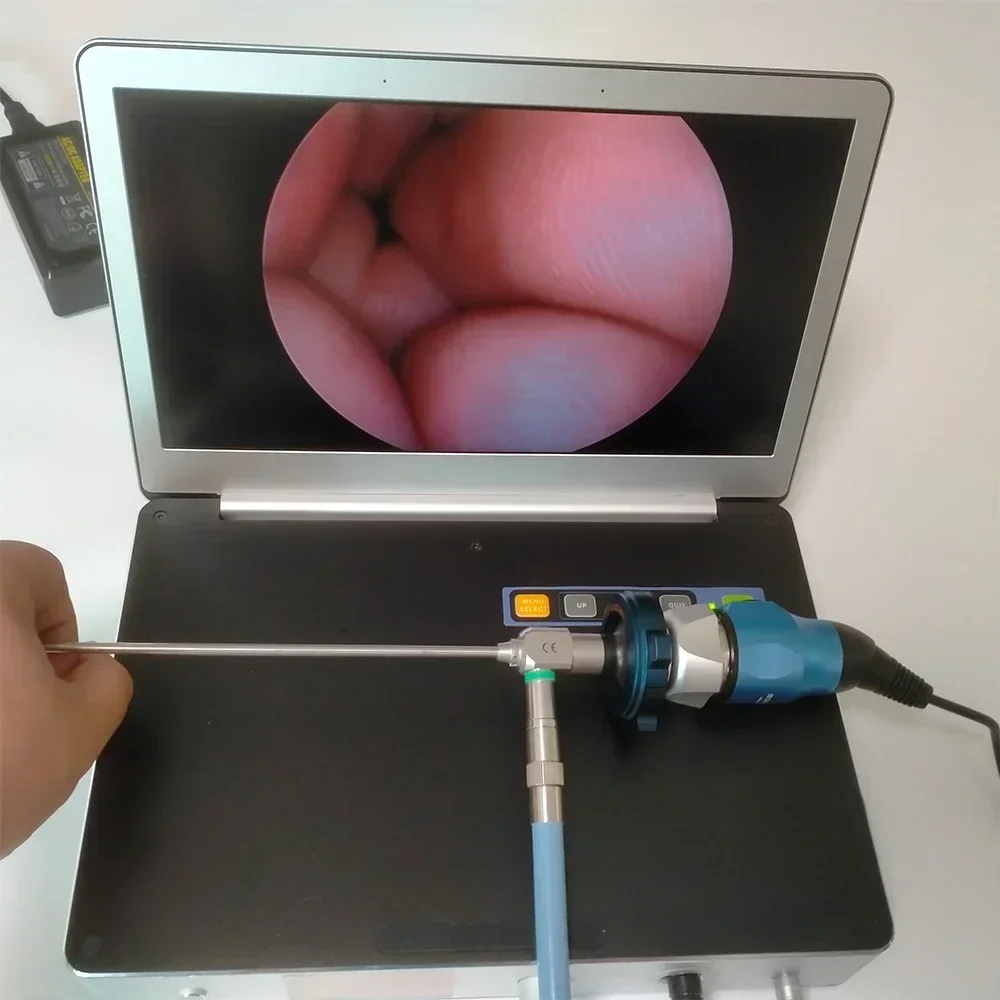 Tragbare endoskopische Endoskop-HD-Kamera