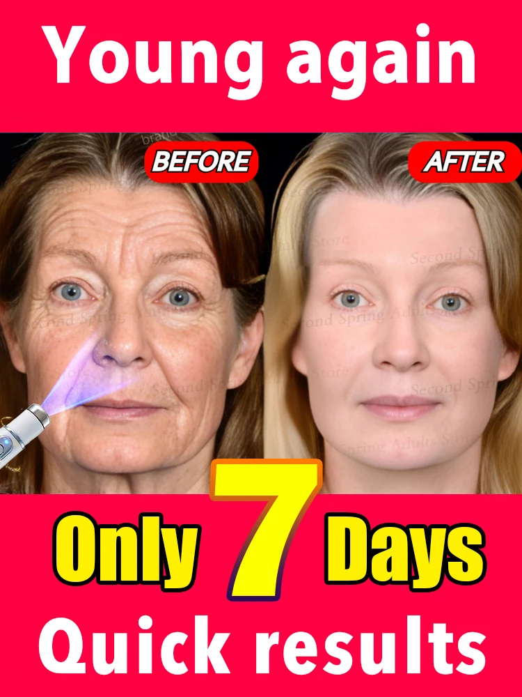 

Erase Wrinkles in Just 7 Days Make you beautiful again