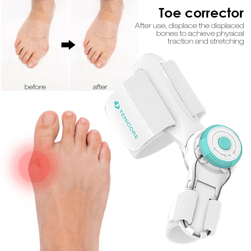 Bunion Splint Big Toe Straightener Bunion Corrector For Woman Men Knob Hallux Valgus Correction Orthopedic Pedicure Foot Care