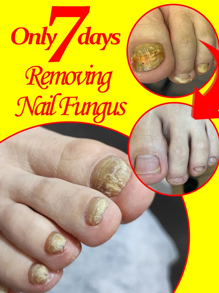 

маникюр для плоха. Может в 7-дневном прощальном доме. Подходит для всех возрастов.