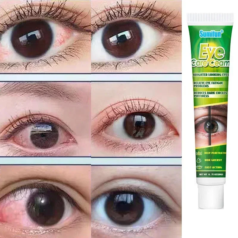 Chinese Herbal Medicine Eye Care Creme, olhar mais brilhante olhos aliviar, fadiga problemas, reduz círculos escuros e inchaço