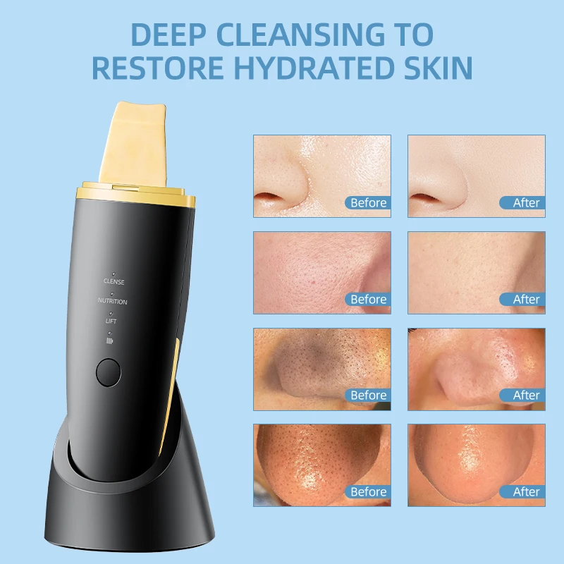 Nieuwe Ultrasone Huid Scrubber Trillingen Gezicht Spatel Comedondrukker Schop Schoon Cavitatie Peeling Facial Lifting EMS Machine