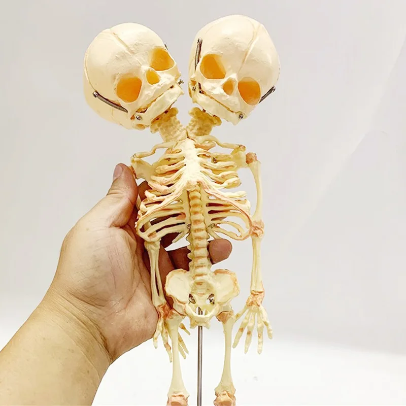 bebe-humano-deformado-para-doble-cabeza-esqueleto-de-craneo-modelo-de-anatomia-herramienta-de-ensenanza-de-estudio-de-exhibicion-de-ciencia-medica