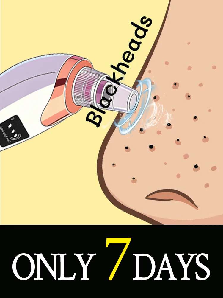 

Инструмент для очищения лица, праздничные акции, вакуумный очиститель пор от черных точек, средство для удаления прыщей и акне.