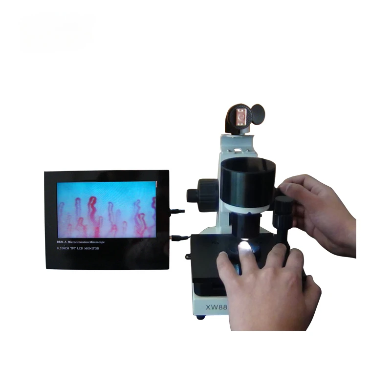 

color capillary microscope Microcirculation microscope portable clinical l capillaroscope sub health monitoring microscope