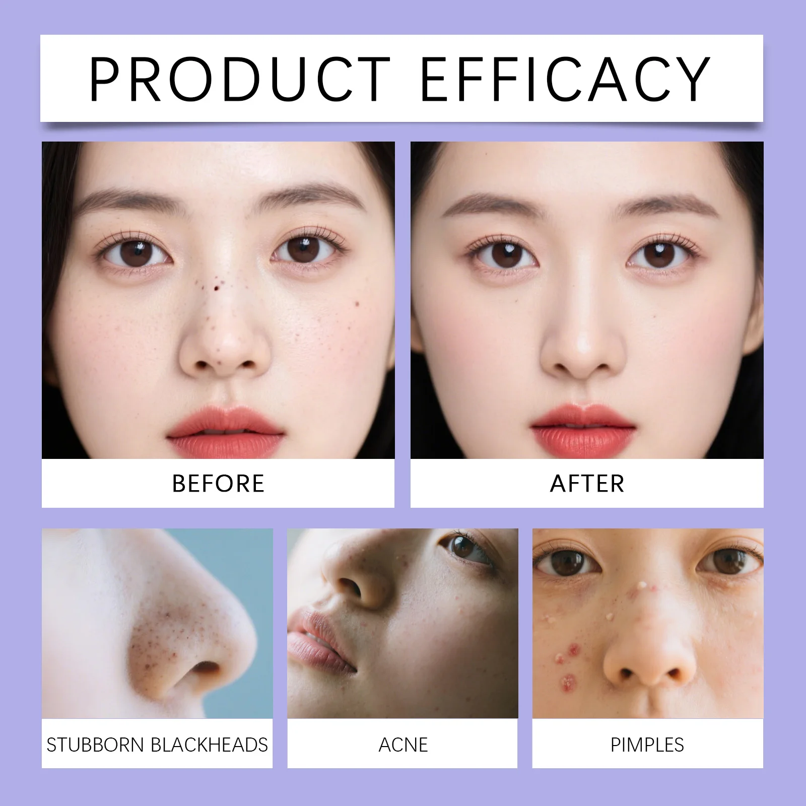 مزيل الرؤوس السوداء شرائط تنظيف المسام الكولاجين التطهير العميق شرائط الأنف السيطرة على النفط لطيف حب الشباب المسام تقليل العلاج #6