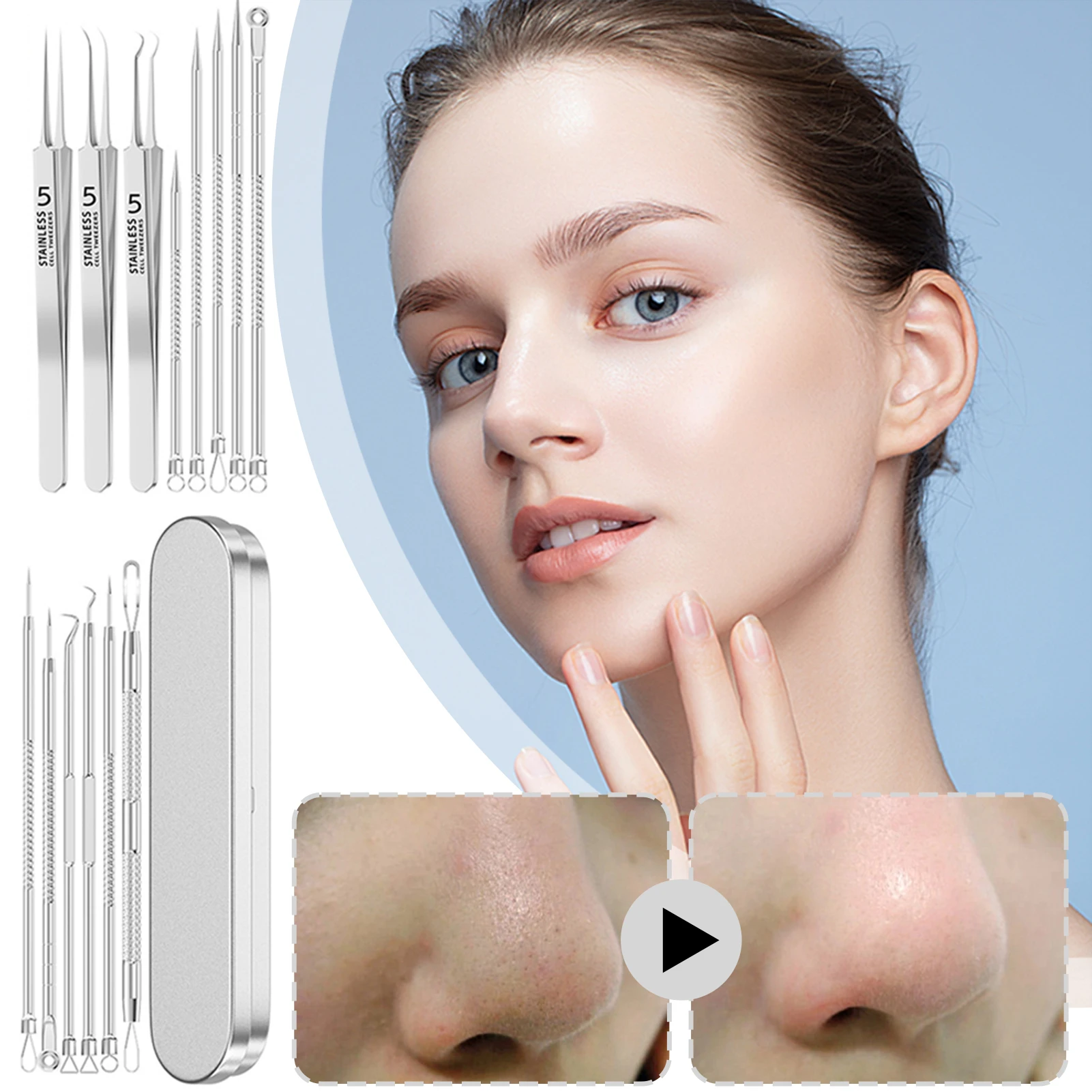 Zestaw do usuwania zaskórników ze stali nierdzewnej Przenośny Łatwy w czyszczeniu z pudełkiem do przechowywania do podróży domowych