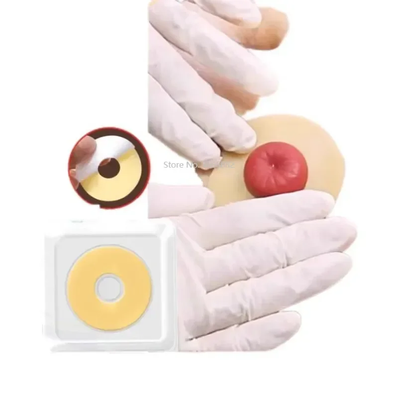 

10 Pcs 2mm/4mm Ostomy Barrier Rings Hydrocolloid Absorb Moisture Skin Friendly Adjust shape Anti-leak Protective Stoma Care