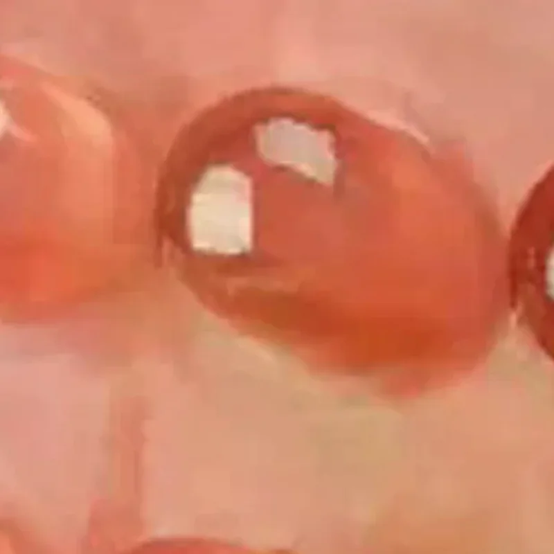 

Массажный роллер Гуаша с 18 шариками из натуральной смолы для талии, шеи, спины, ног, тела, для снятия напряжения, антицеллюлитный, для СПА-процедур