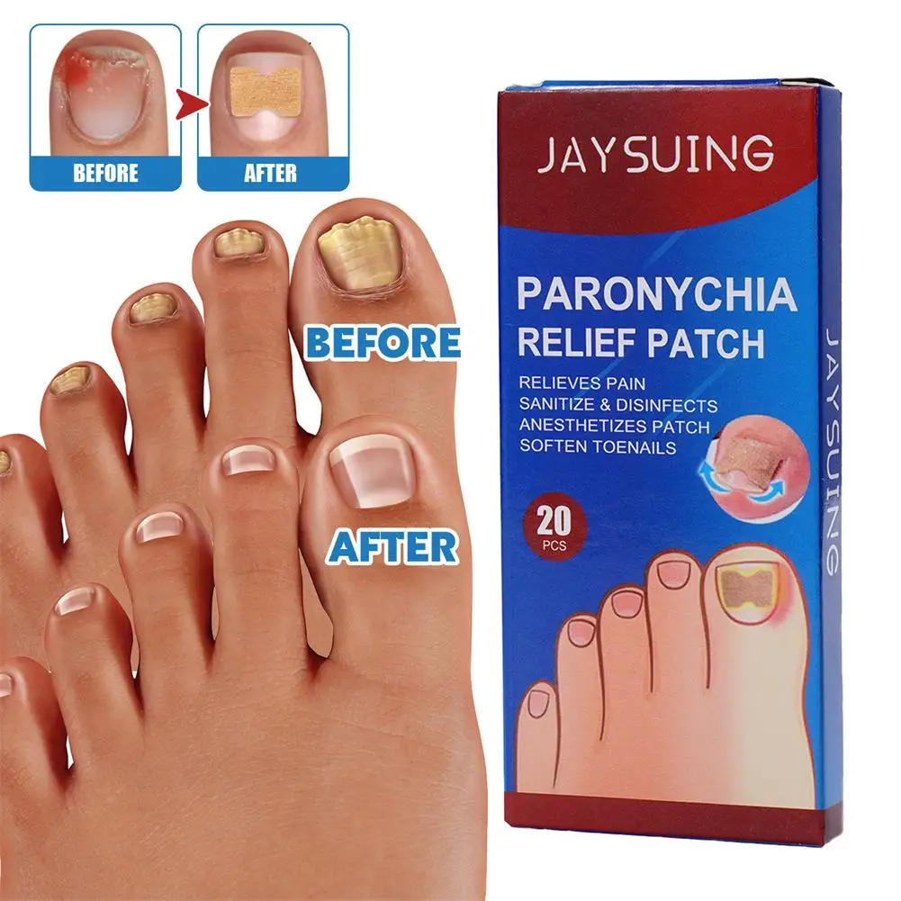 Paronychia Relief Patch Toenail Nail Ingrown Correction Stickers Nails Care Recover Protector Tool For Removal Of Ingrown N Q7J9