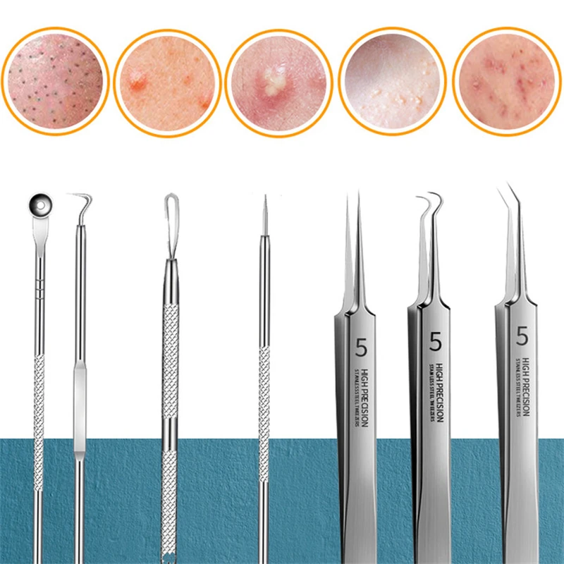 11 pz/set ago per l'acne rimozione di Clip per punti neri estrazione pori detergente per la testa nera cura della pelle del viso strumento per la pulizia dell'ago morsetto per cellule