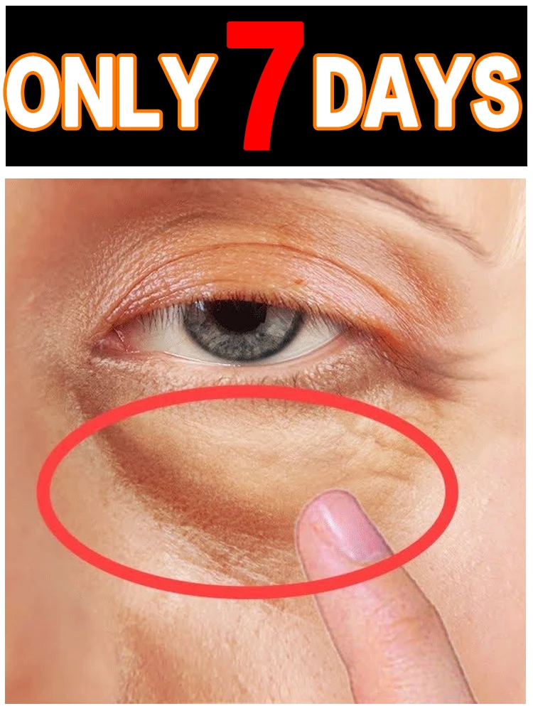 

Hot-selling eye care tools more bottles for more discounts