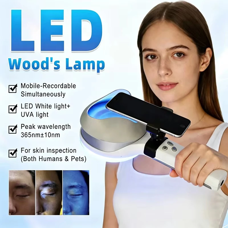 KN- 9000B CE PMA 510K Approved Portable Handheld Dermatology Wood's Lamp Dermatoscope Skin Analyzer
