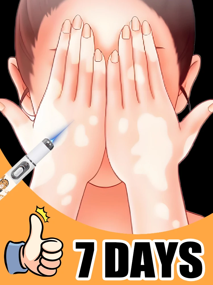 La génération-2 laser dit adieu au vitiligo en 7 jours