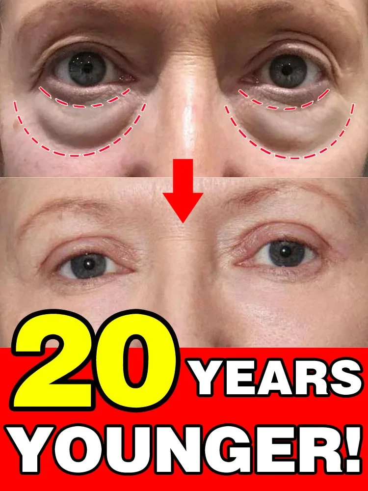 

solve eye problems