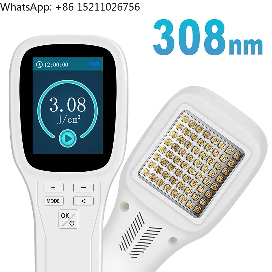 ZJZK professional 308nm excimer phototherapy device for vitiligo psoriasis treatment no side effects