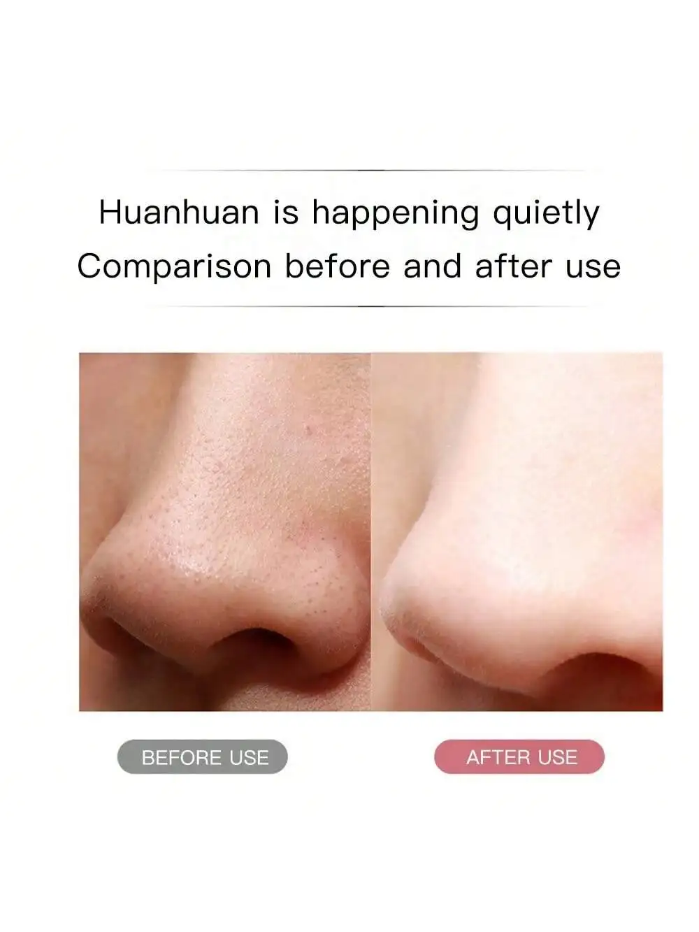Ultrasone Huid Scrubber Scrubber Diepe Trillen Gezichtsreiniger Schop Gezicht Scrubber Peeling Black Head Remover Gezichtsmassager