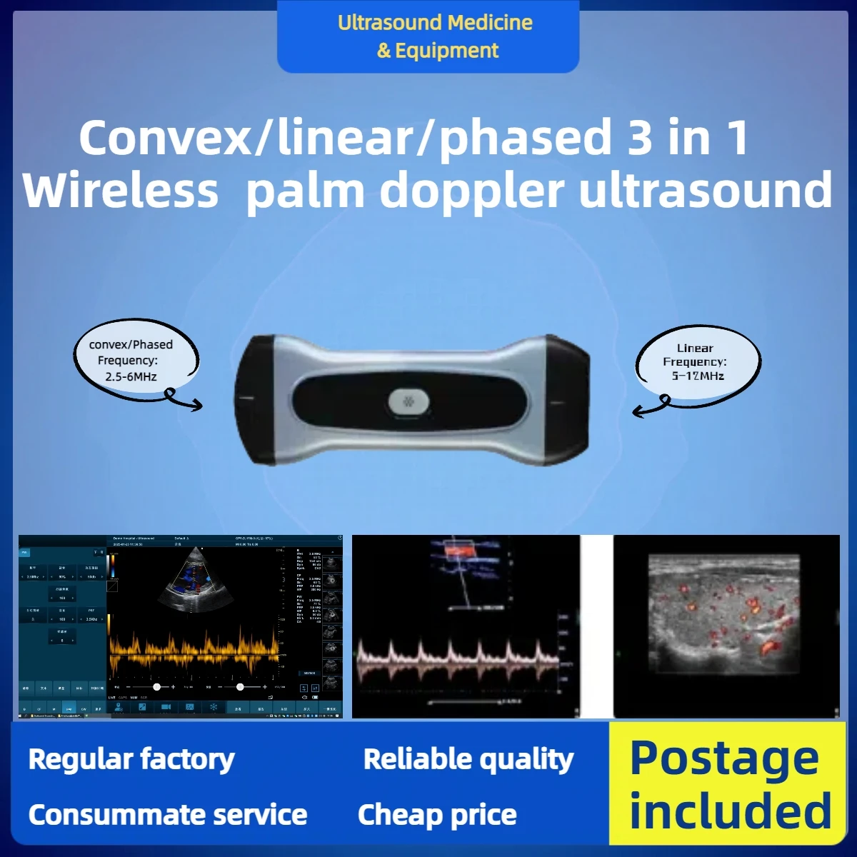 Товары премиум-класса, выпуклые/линейные/фазированные матрицы, три в одном, беспроводной допплеровский ультразвуковой ультразвуковой аппарат с ручкой Товары премиум-класса, выпуклые/линейные/фазированные матрицы, три в одном, беспроводной допплеровский ультразвуковой ультразвуковой аппарат с ручкой