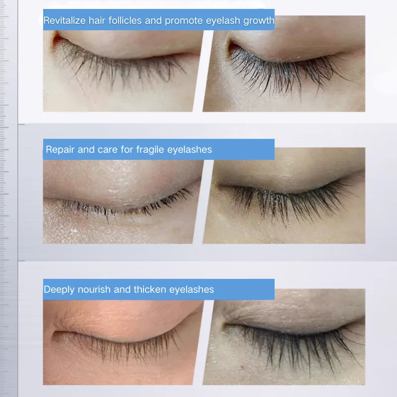 まつげの急速な増量と長さを実現するまつげ美容液、より濃く長くする眉毛美容液、韓国コスメ