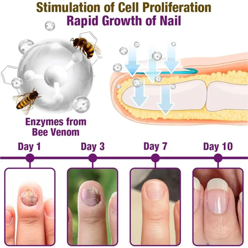 Hot Defense Nail Treatment Serum Bee Venom Nail Growth Nail Growth Serum Nail Repair Bee Venom for Nail Strengthener