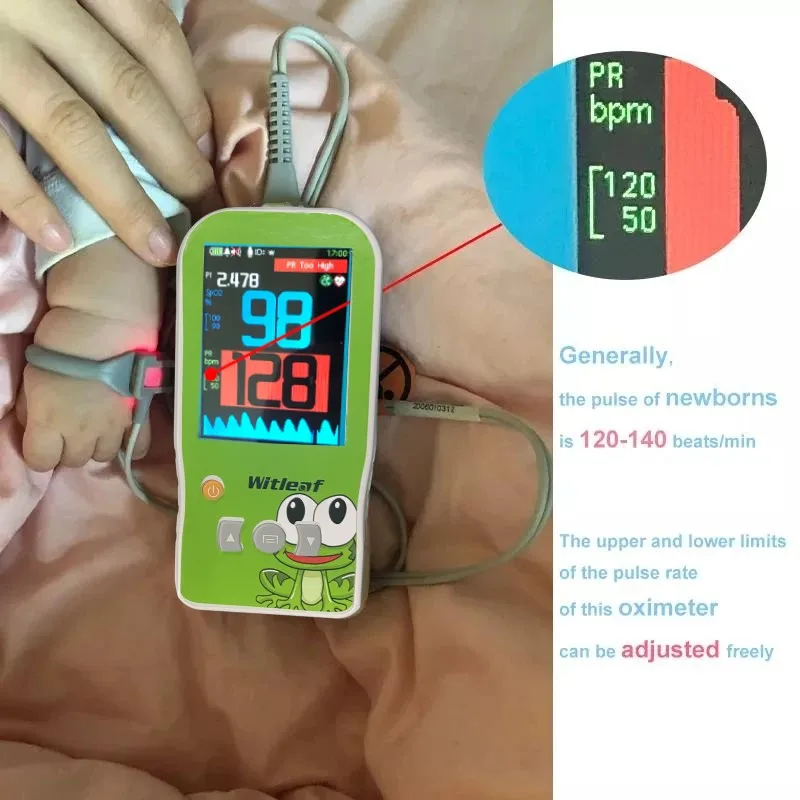 Witleaf Baby Handheld Oximeter Pulse Oximetro SPO2 PI PR Heart Rate Monitor for Neonatal Mother Kids Adult Pediatric Medical