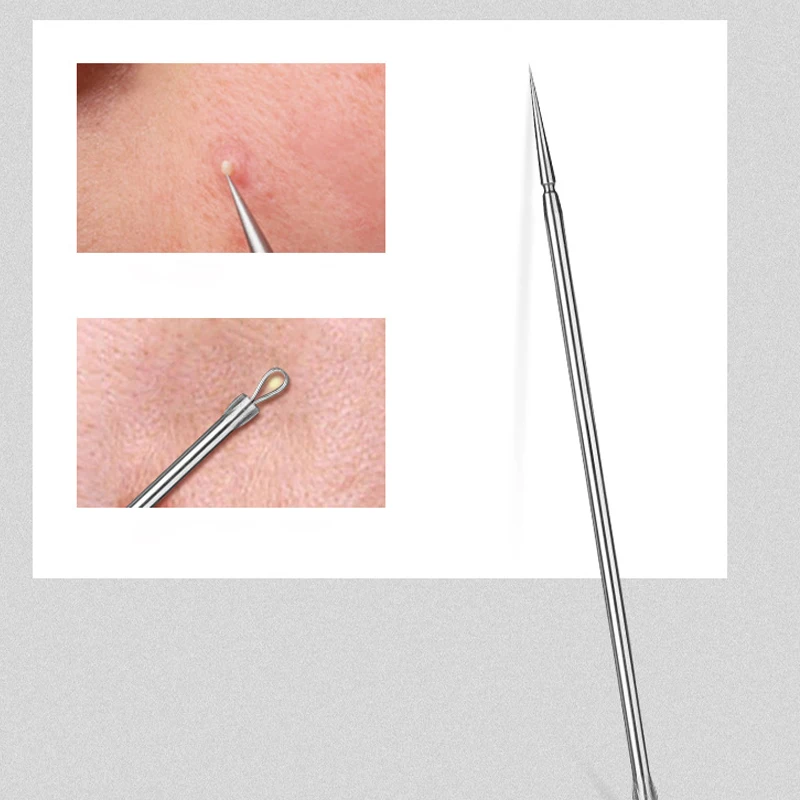 8/7/5/4 pezzi in acciaio inossidabile strumenti per la rimozione dei punti neri del viso set pinzette per punti neri bellezza rimozione dei punti neri strumento per l'ago dell'acne