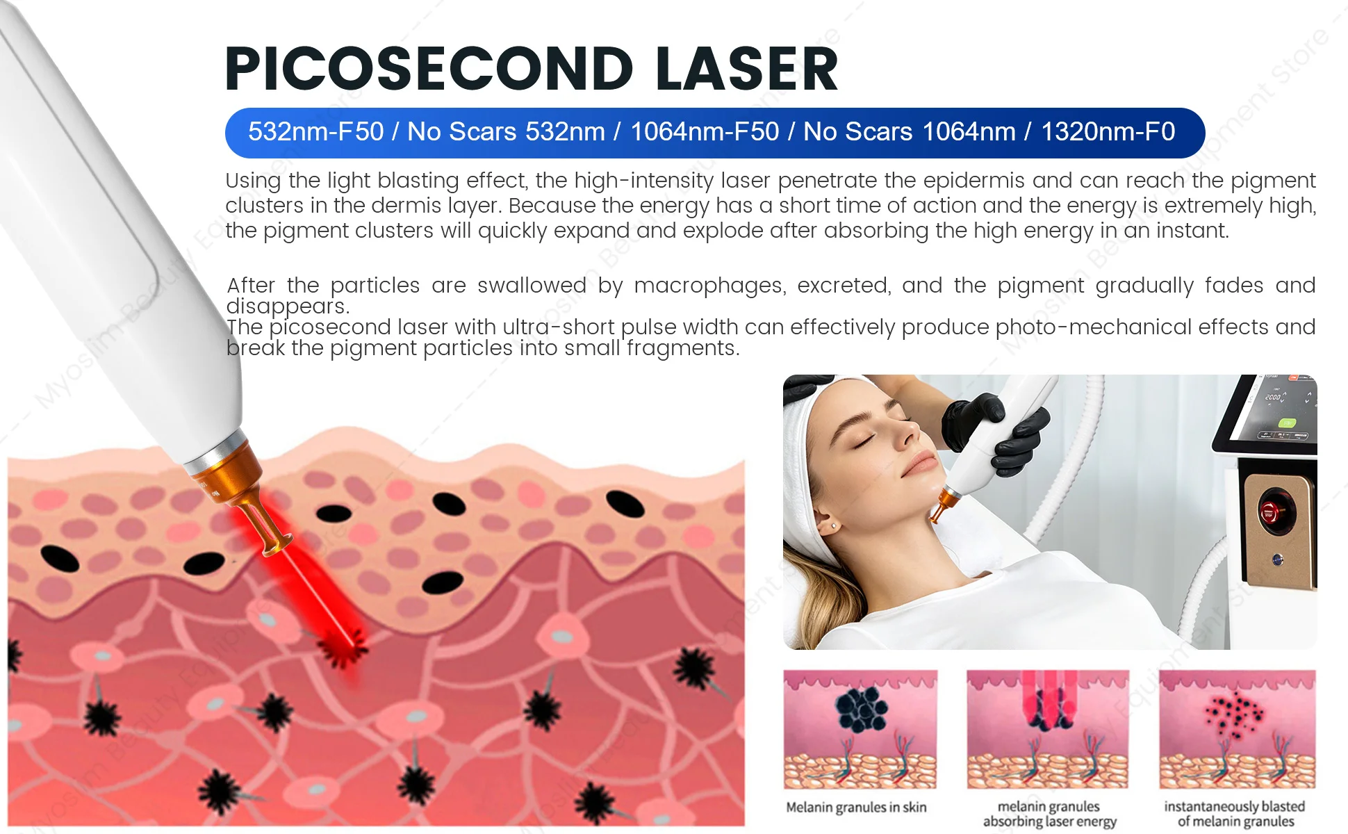 2-in-1 Haarentfernungsgerät Schönheitsausrüstung Permanentes Haarreduktionsgerät mit Kühlsystem für Salon und Spa – Detail 12