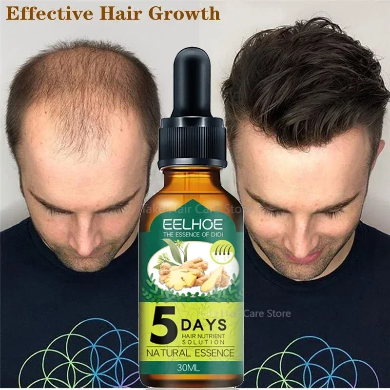 5 Days Ginger Fast Hair Growth Essential Oil Natural Anti Hair Loss Prevent Baldness Treatment Fast Growing Nourish Dry Damaged