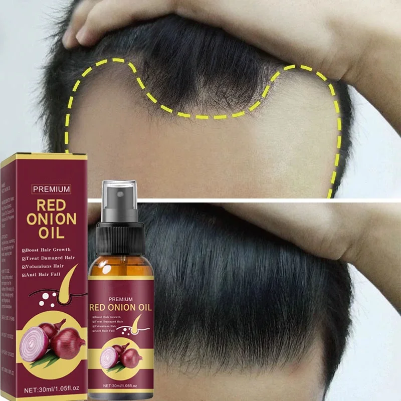 Serum penumbuh rambut, semprot memperbaiki akar penumbuh rambut Anti rambut rontok perawatan kuat untuk pria wanita perawatan rambut