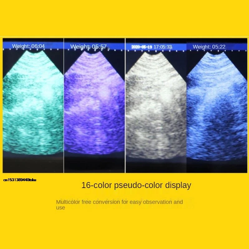 

Promotion 5.6 Inch LCD Screen Portable Veterinary Ultrasound Scanner For Cattle Cow Pig Horse Ultrasound pregnancy testi 2025