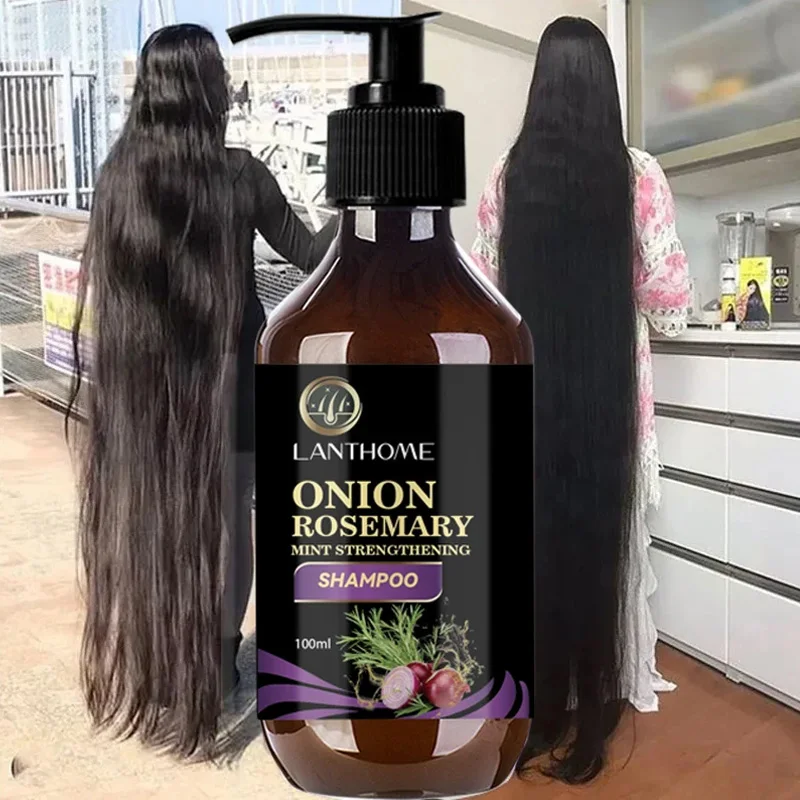 Rosemary Hair Care Shampoo Onion Plant Essence Can Rapidly Grow Hair Effectively Prevent Hair Loss  Clean  Plump And Smooth Hair