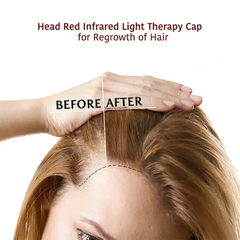 USB recarregável Anti-Hair Loss Infrared Light Cap, Luz vermelha LED, Tratamento do crescimento do cabelo, Promover o cuidado do crescimento do cabelo