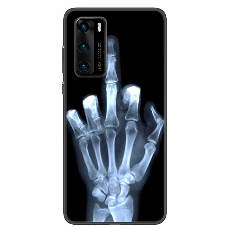 For ZTE Blade V40 Vita Case Black Silicone Soft Back Cover Case For ZTE Blade A72 V40 Vita Phone Case Cover A 72 V 40 Vita Funda