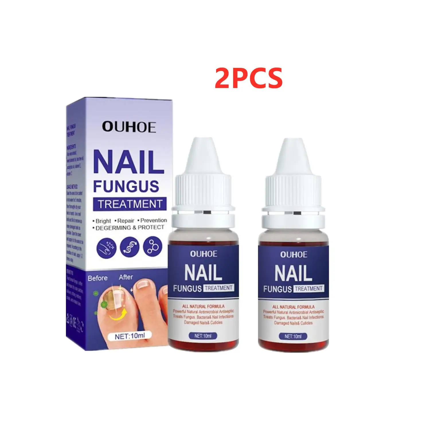 Unha Tratamento Fungal, Pés Essence Care, Anti-Infecção, Paroníquia, Toe Fungus Repair, Nail Fungal Serum, Onicomia Remoção, 2pcs