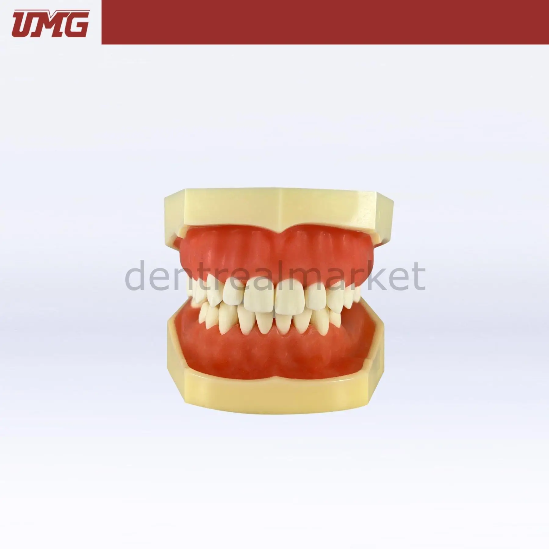 UMG Dental - Umg Model Implant Training Model Upper-Lower Jaw - UM-2030