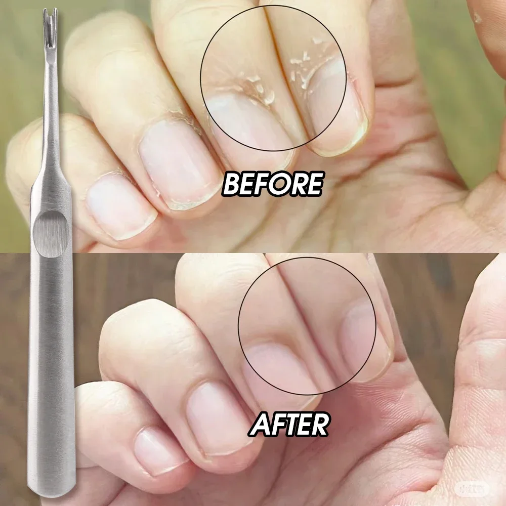 Dissolvant professionnel en acier inoxydable pour la peau, poussoir à double tête, lifting des ongles, outil de manucure