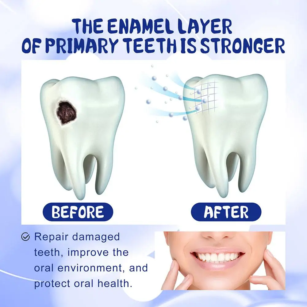 Crema de reparación de Caries dentales, pasta de dientes antidecaimiento, previene la Caries, protege la TeethDeep Clean, blanqueamiento y aliento fresco