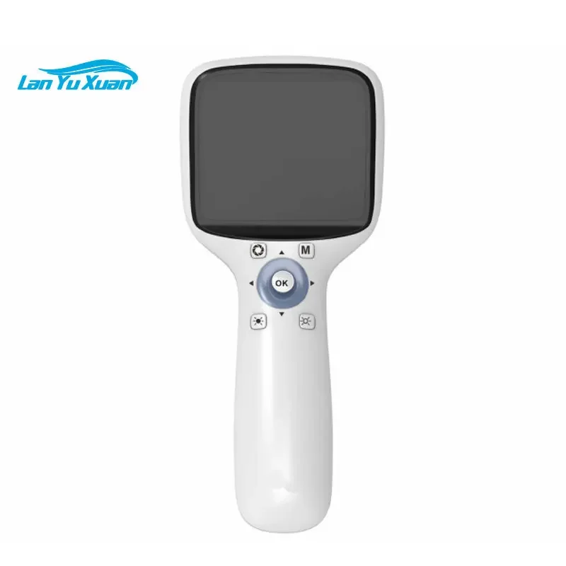 MY-V038 plus ophthalmology equipment portable eye fundus camera handheld