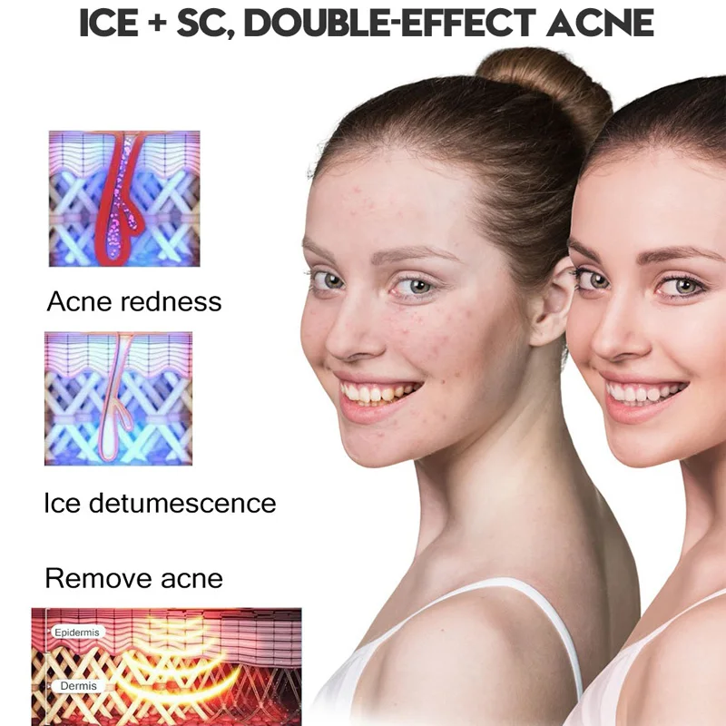 Máquina de depilación láser con refrigeración por hielo para uso doméstico, rejuvenecimiento de la piel indoloro, depilación Ipl, novedad de 2024