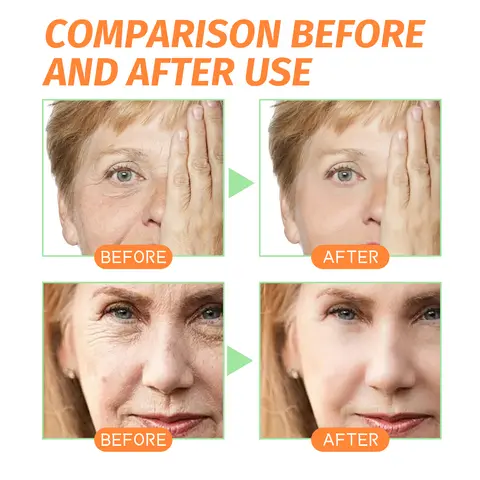 Ozon ansiktsångare varm dimma luftfuktare för ansikte djuprengöring förångare spruta salong hem spa hudvård vitare 8 best sales ansiktsfuktighetskräm - №7