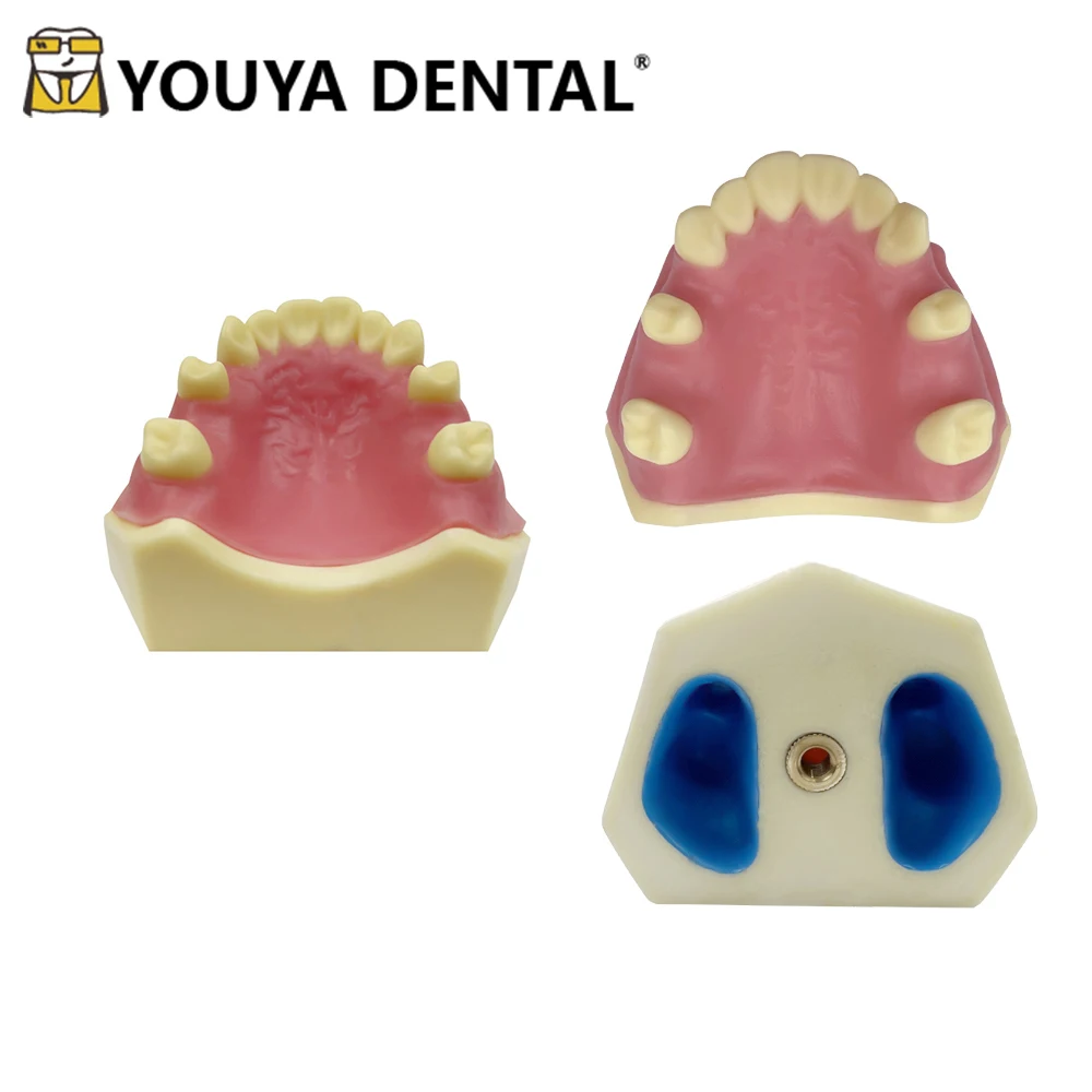 Dental Mandibular Sinus Implant Practice Model of Missing Tooth For Dental Technician Studying Training Teaching Model