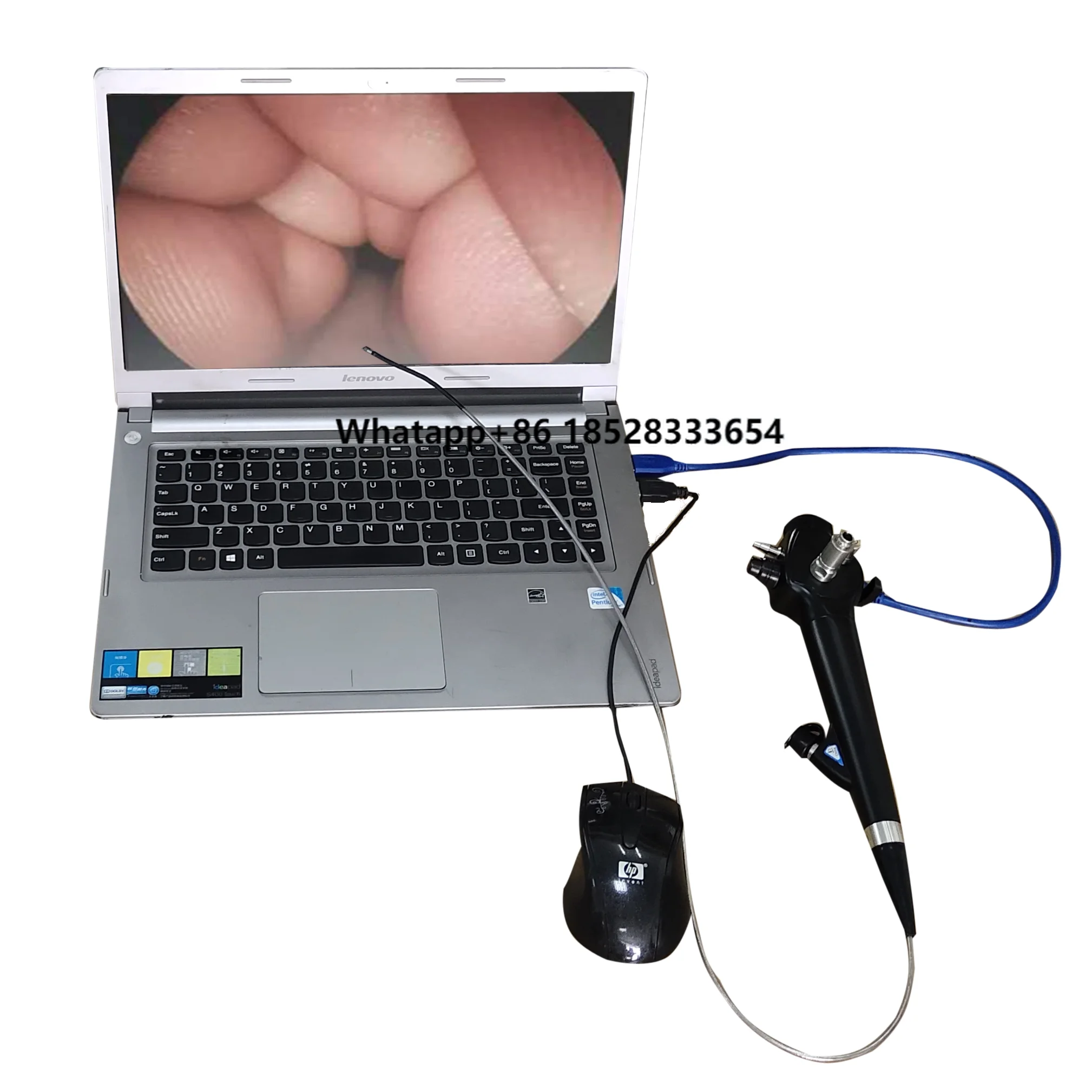 

Versatile Portable ENT Endoscope - Lightweight Design With LED Illumination For Clear, Detailed Imaging Of Nasal