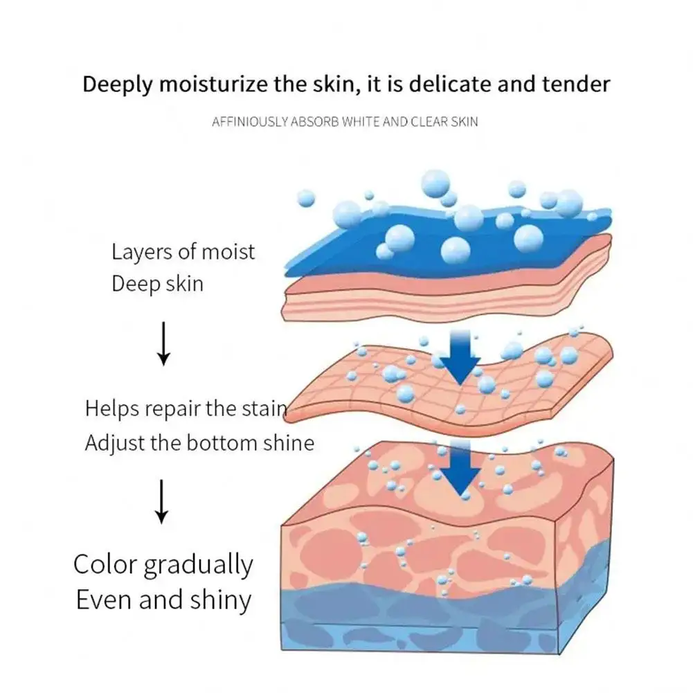 Crema para el tratamiento del acné a base de hierbas, elimina el Melasma, manchas oscuras, piel de la cara, ilumina el acné, ilumina el tono, marcas de cuidado, F3R6