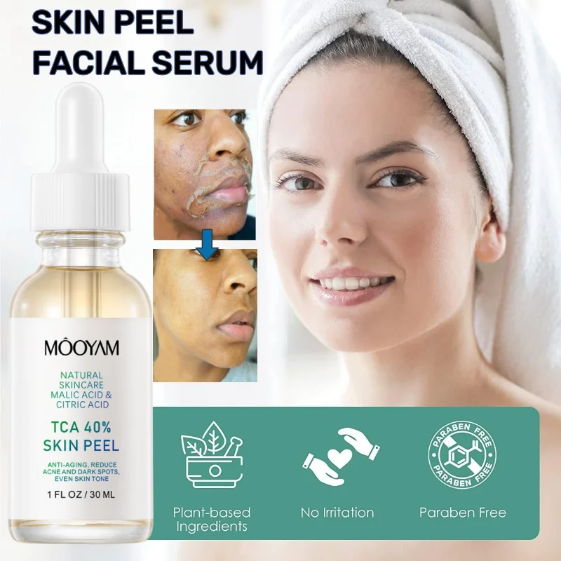 Facial Peel Chemical Peel 40 Percent Peeling Serum Peeling for Face Facial Exfoliant for Dark Skin  Dark Spots Acne Blemish