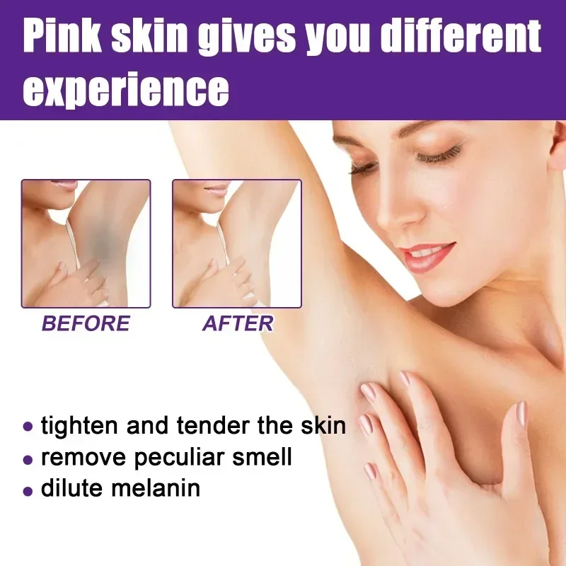 Sdotter New Brighten firming skin Body Whitening Cream Private Parts Underarm removal melanin Armpit knee Elbow Neck Lips Dark S