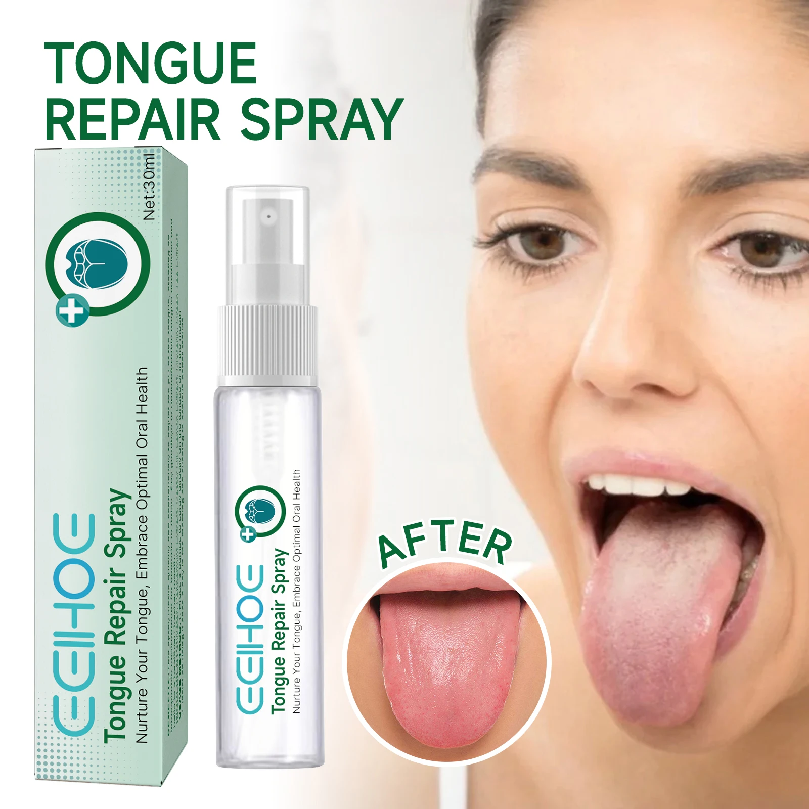 Cracked Tongue Relief Spray Relieves Chapped Swollen Tongue Remove Bad Breath Oral Hygiene Cleaning Prevent Ulcers Tongue Spray