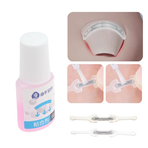 Imagen 2 del producto Cuidado de las uñas corrección de uñas encarnadas tratamiento de uñas encarnadas parche elástico pegatina alisado Clip herramienta de pedicura