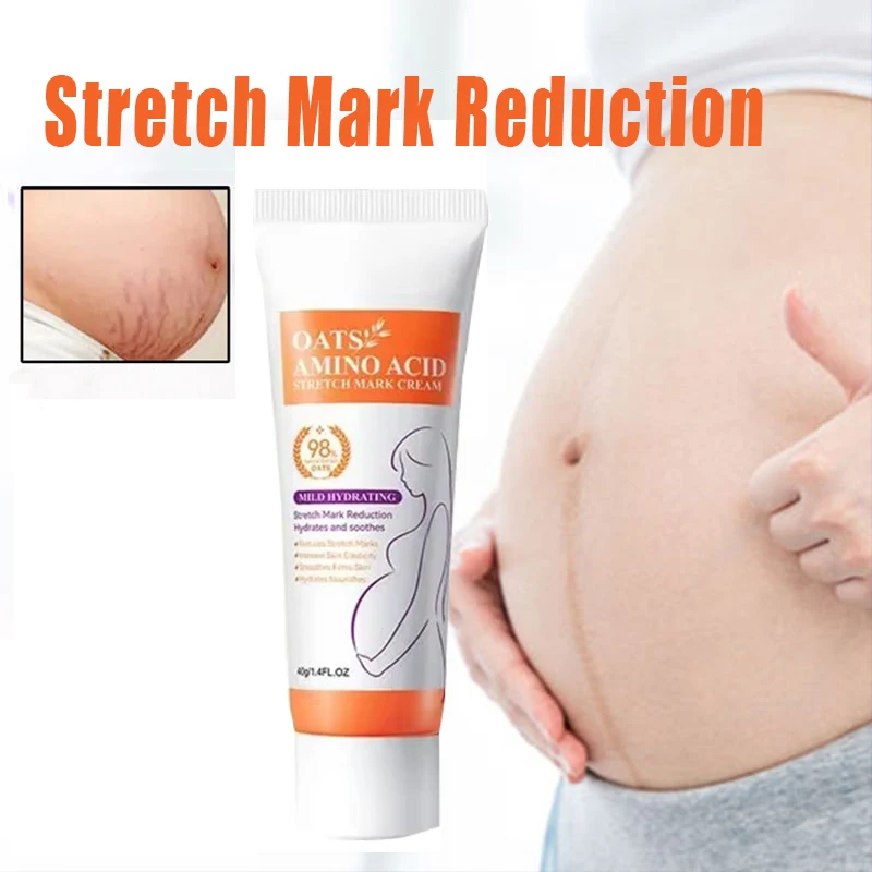 

Eliminate Body Belly Stretch Marks Removal Swelling Marks Remove Skin Cracks Repair Firming Care Stretch Marks Moisturize Cream