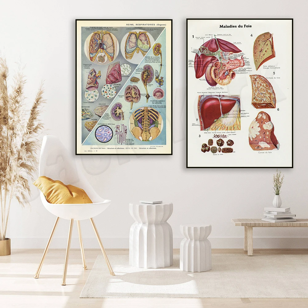 Small French vintage liver medical print, lung kidney print, anatomy poster, doctor office wall art medical gift decoration